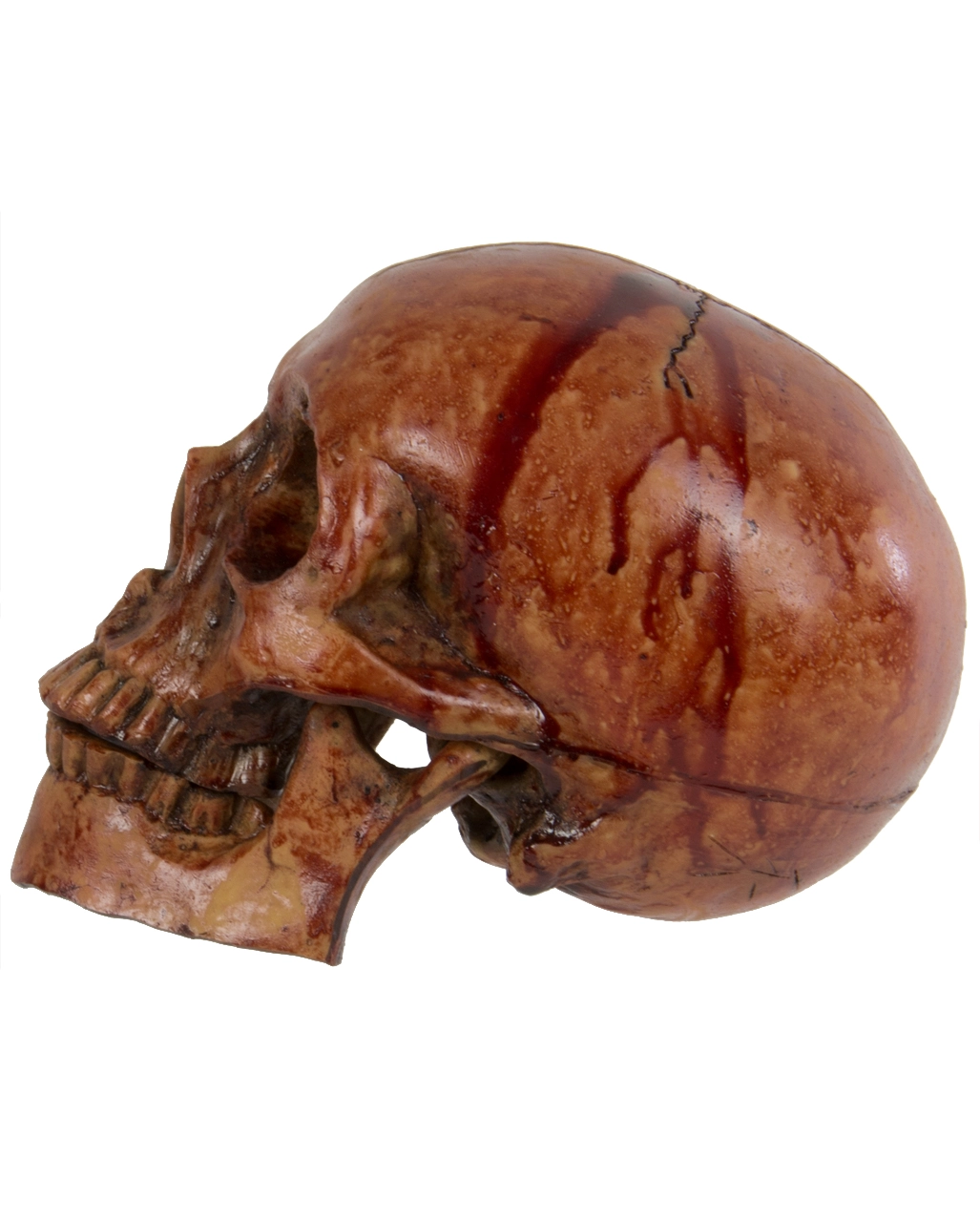 Blutiger Skull Mit Beweglichem Kiefer 4 Blutiger Skull Mit Beweglichem Kiefer – Bild 2